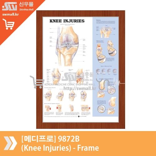 [메디프로]9872B(Knee Injuries)