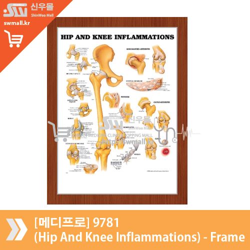 [메디프로]9781(Hip And Knee Inflammations)